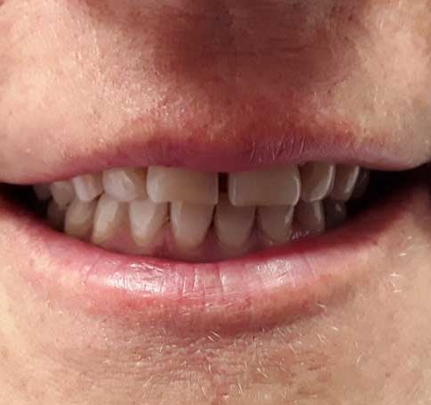 Dental Gallardo