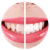 Dental Gallardo icono blanqueamiento