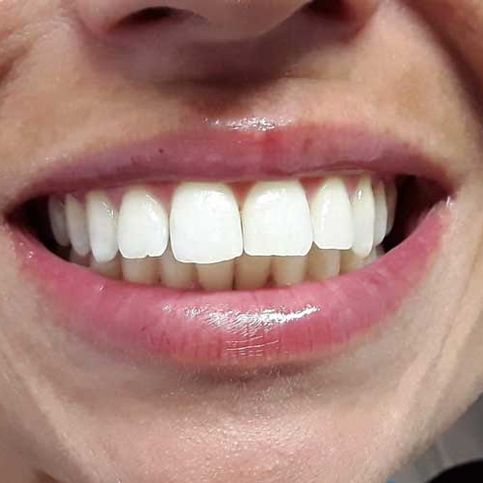Dental Gallardo