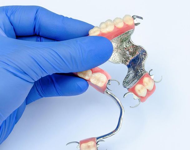 Prótesis dentales