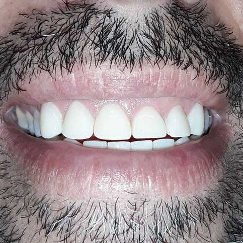 Dental Gallardo